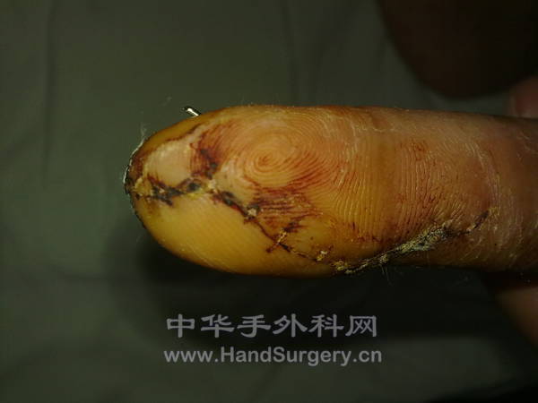 20121017617.jpg