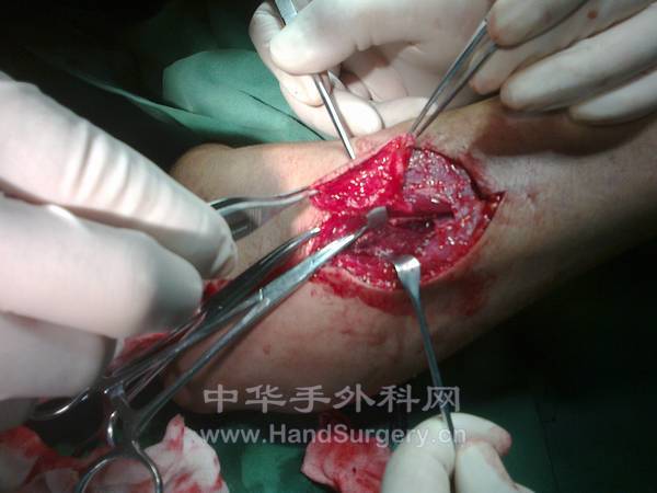 20120820304.jpg