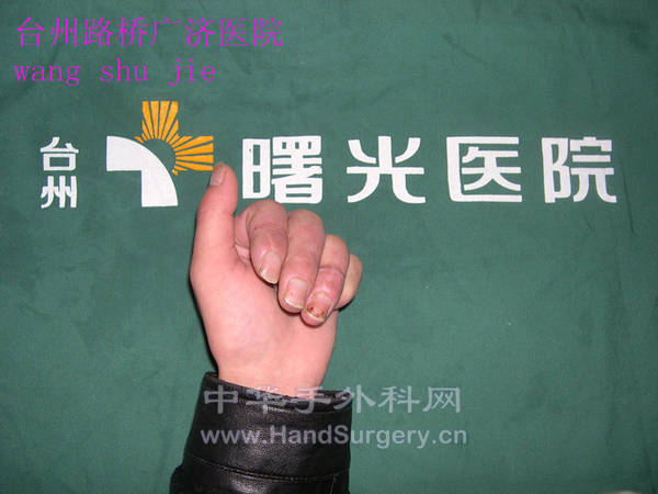 术后三个月