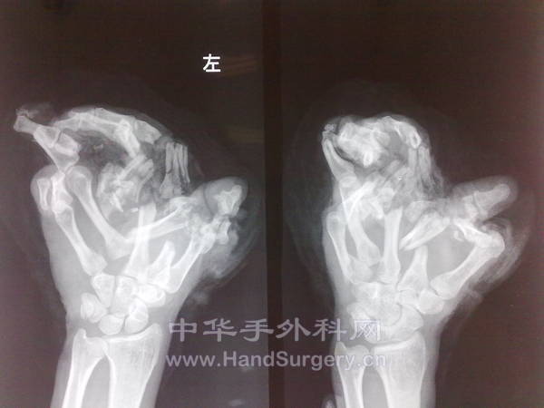 20120831177.jpg