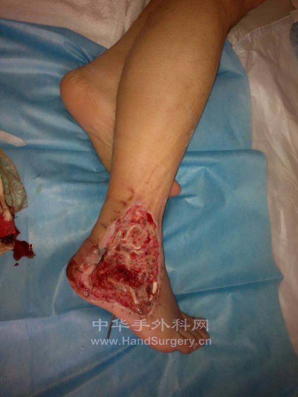 201204091141.jpg