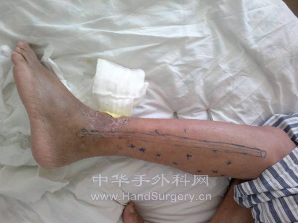 201204151177.jpg