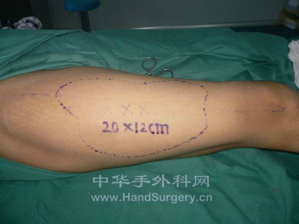 nEO_IMG_杨新建16.jpg