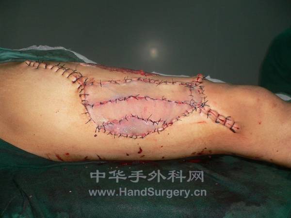 nEO_IMG_杨新建25.jpg