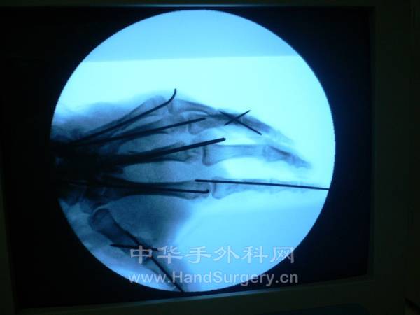 nEO_IMG_杨06.jpg