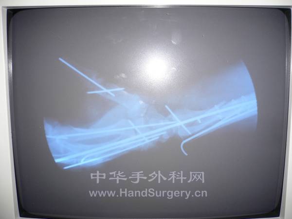 nEO_IMG_杨07.jpg