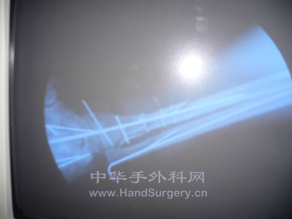 nEO_IMG_杨08.jpg