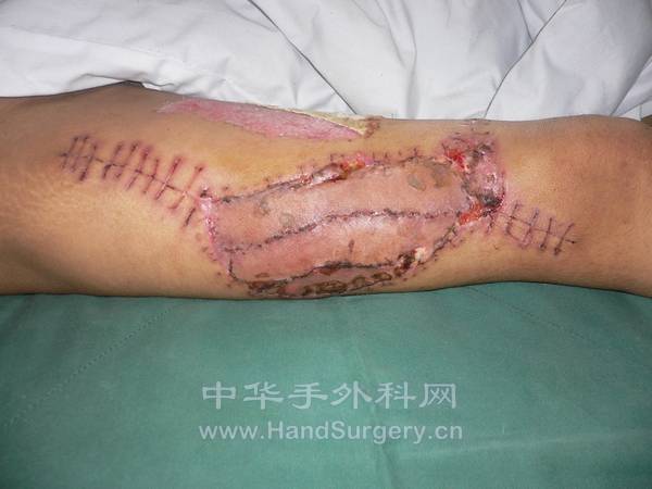nEO_IMG_杨新建31.jpg