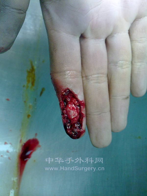 20120422892.jpg