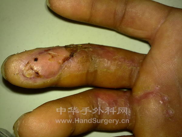 201205251098.jpg