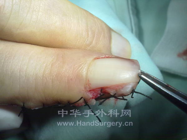 201211261155.jpg