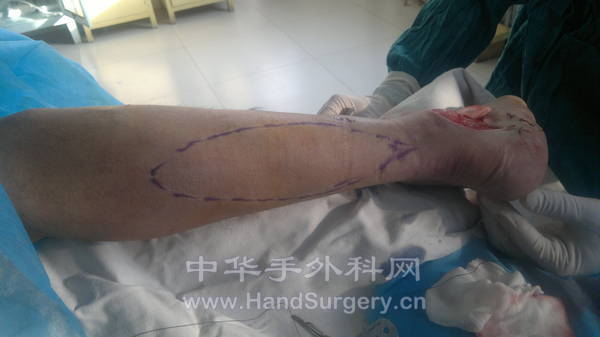 20120313008.jpg
