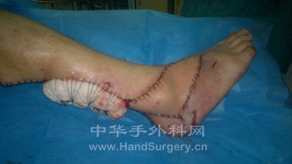 20120313009.jpg