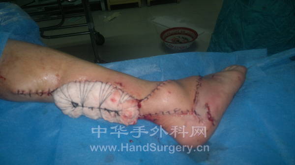 20120313010.jpg