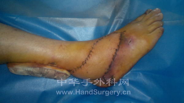 20120319014.jpg