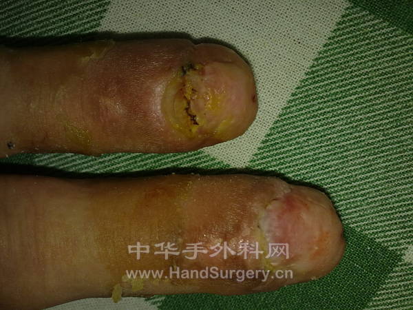 20100531115.jpg
