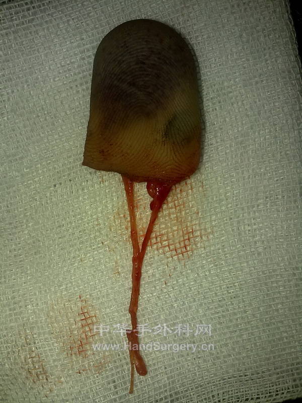 20110506289.jpg