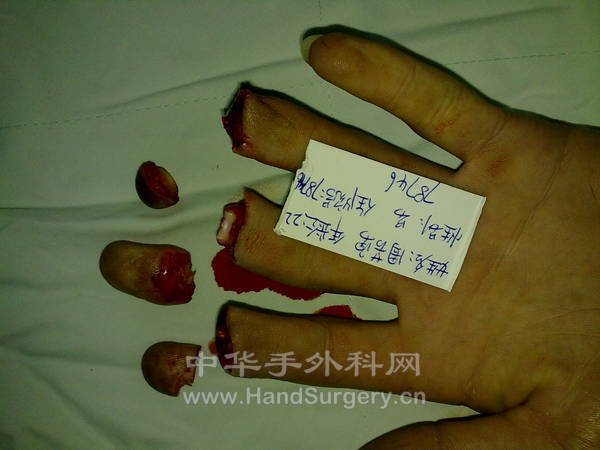 20110604363.jpg