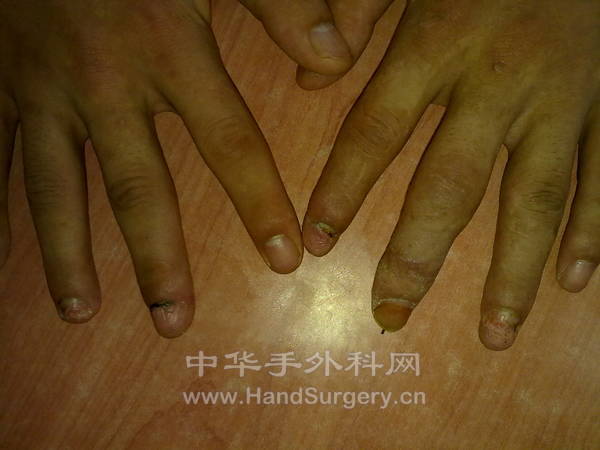 20110722605.jpg