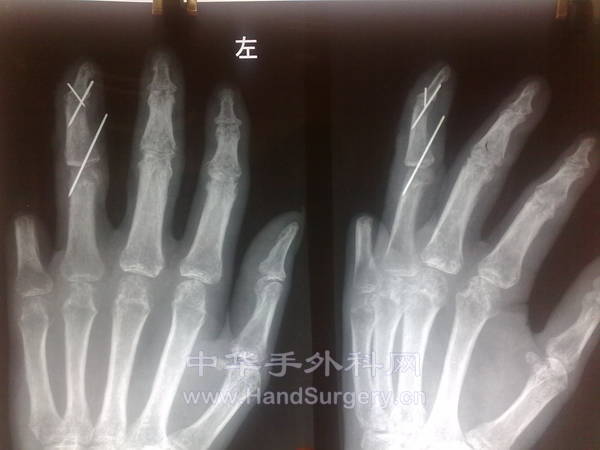 20120909318.jpg