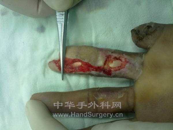 201207021407.jpg