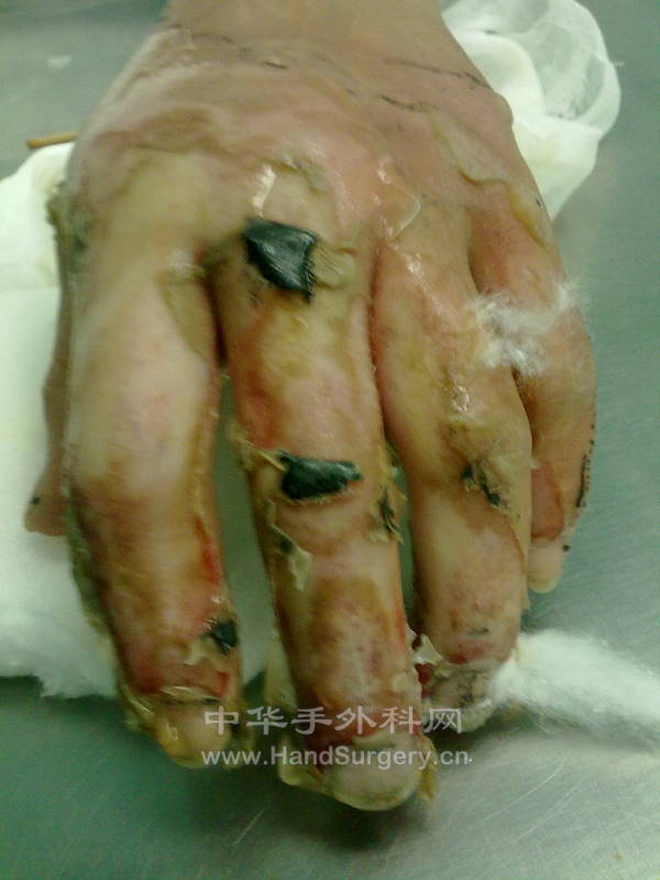 20120327762.jpg