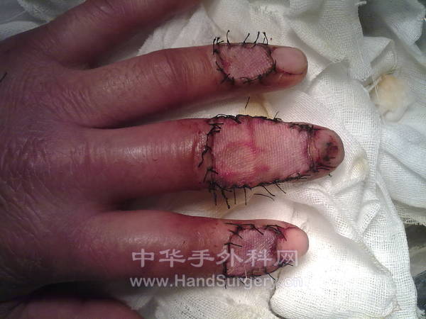 20120330772.jpg