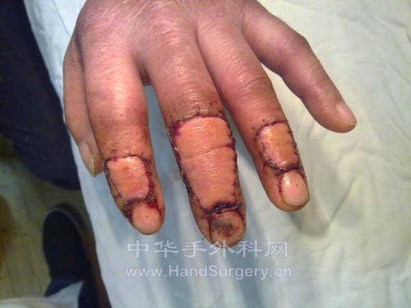 20120403112.jpg