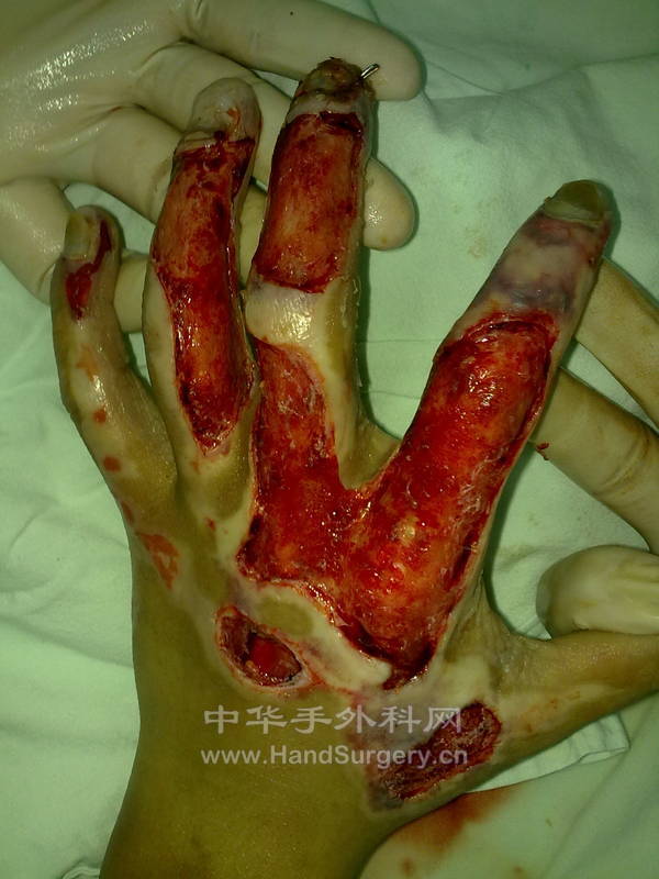 20120425904.jpg