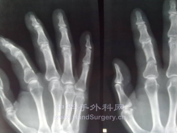 20121203351.jpg
