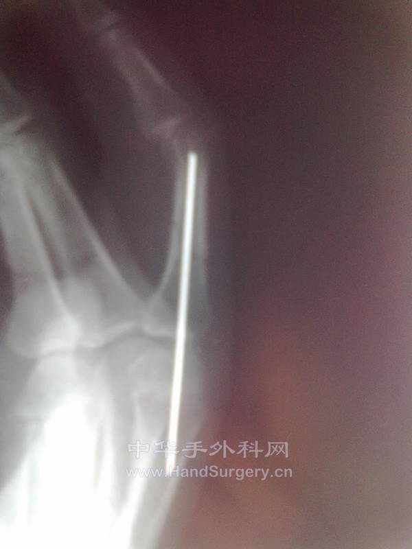 20121203349.jpg