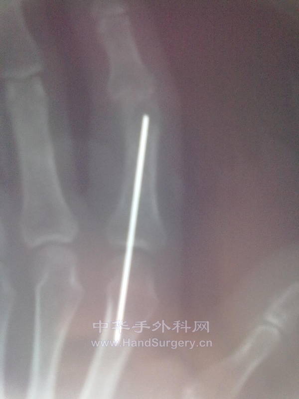 20121203350.jpg