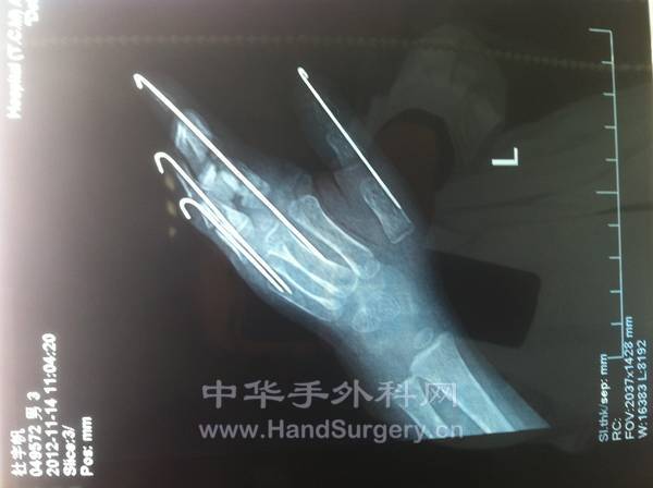 照片 678.jpg