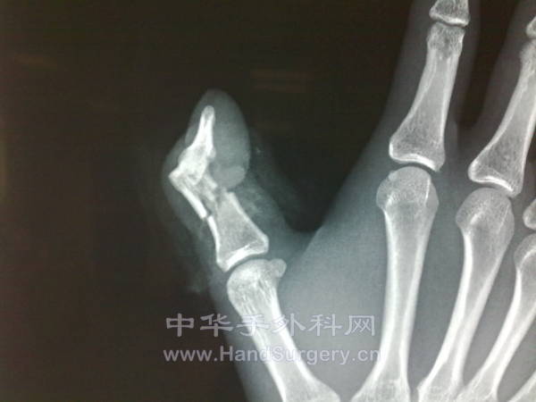 201211141011.jpg