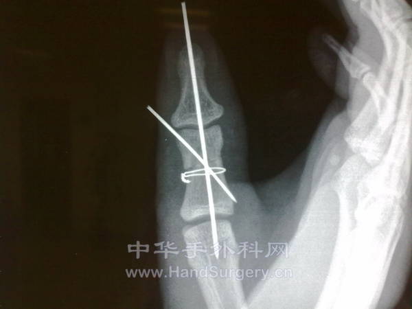 201211141013.jpg