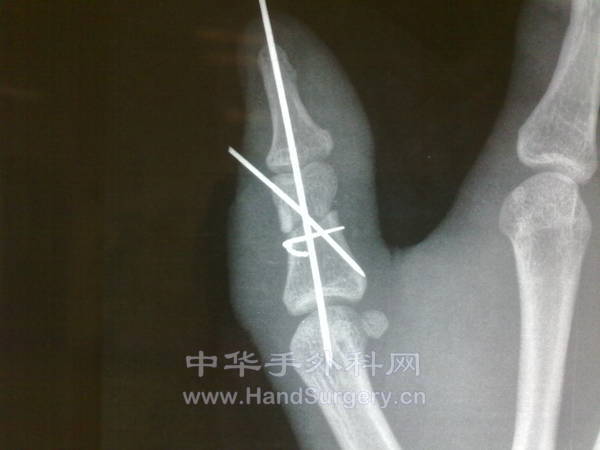 201211141014.jpg