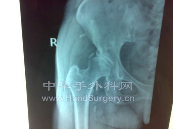 20090113026.jpg