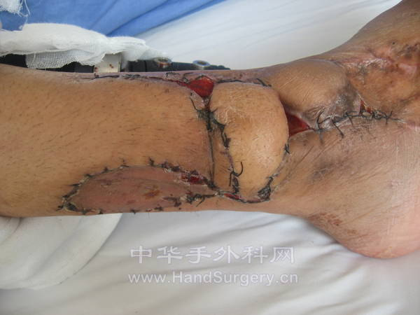 起步 081.jpg