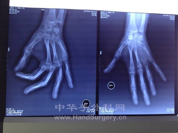 男14岁发现一个星期