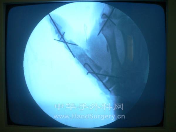 nEO_IMG_柴启臻25.jpg