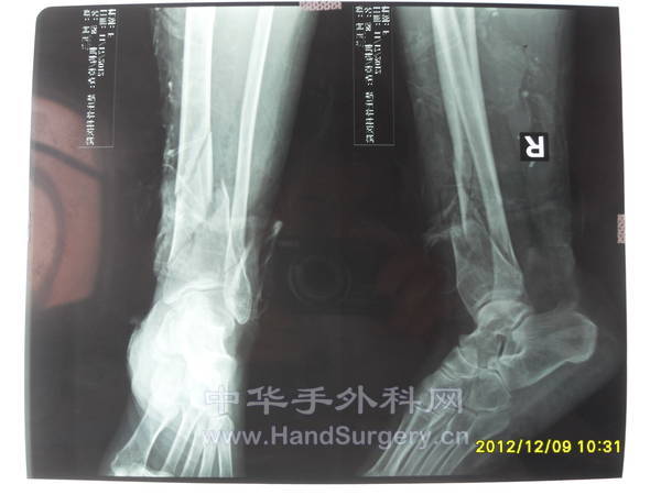 SDC13392.JPG