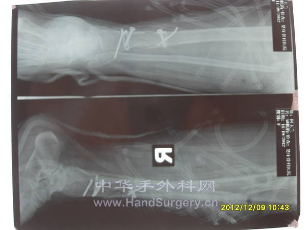 SDC13399.JPG