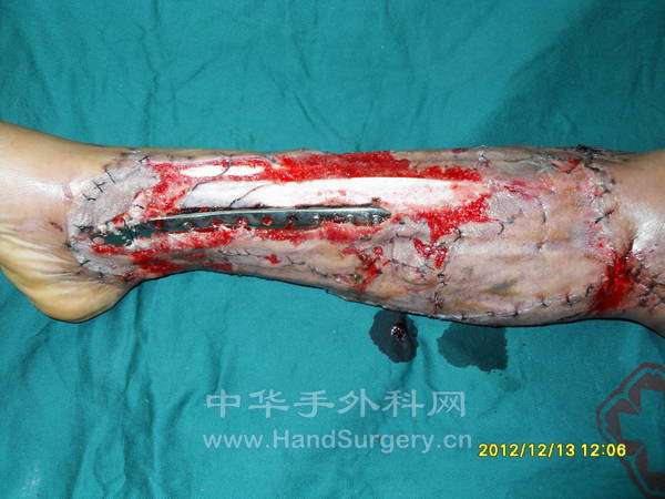 SDC13410.JPG