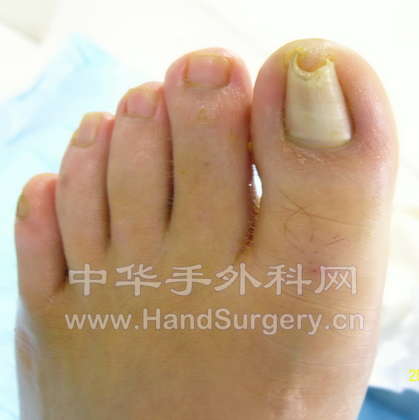 术前1.jpg
