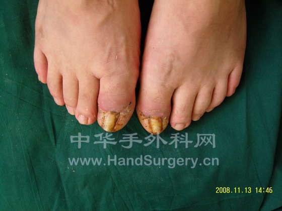 术后两周1.jpg
