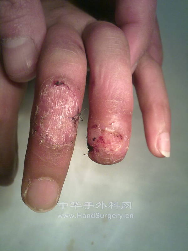 20130103113.jpg