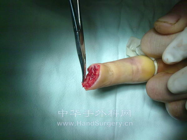 20130105172.jpg