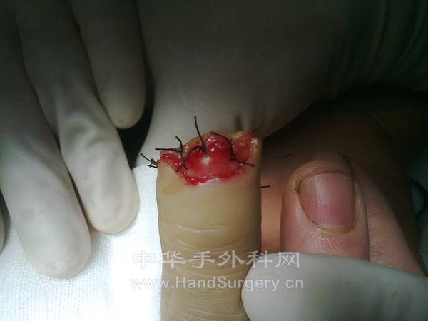 20130105179.jpg