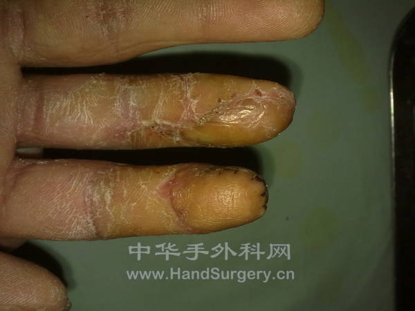 20130101046.jpg