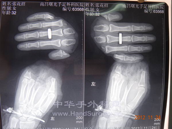 手术前1